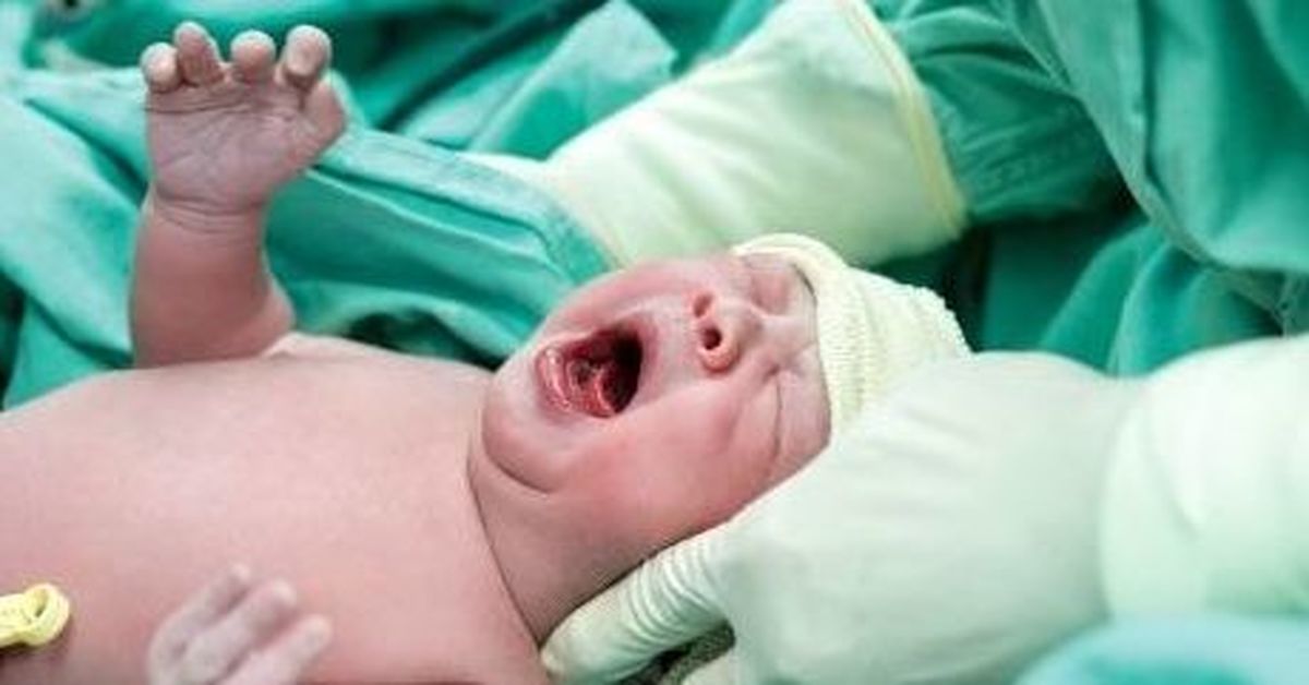 معایب و عوارض جسمی روحی و جنینی زایمان سزارین
