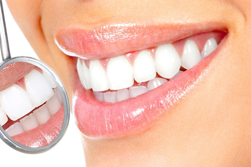 بلیچینگ دندان در مطب و در منزل و عوارض آن