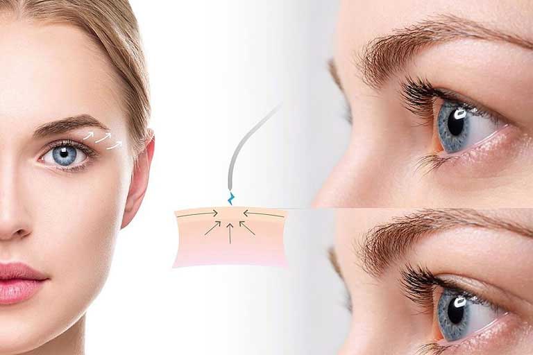 پلاسما تراپی چیست؟ پلاسما تراپی چیست؟