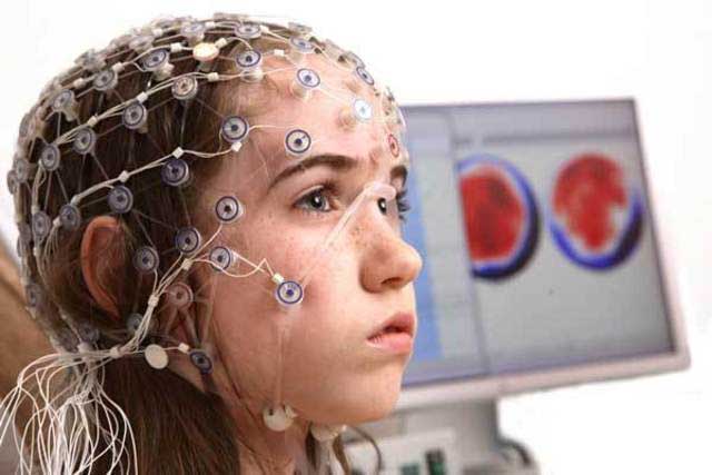 هدف از گرفتن نوار مغز و انجام EEG چیست؟ هدف از گرفتن نوار مغز و انجام EEG چیست؟